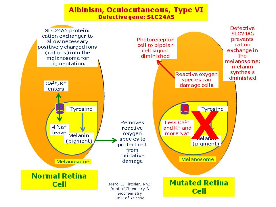 Albinism Oculocutaneous Type VI Hereditary Ocular Diseases